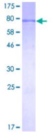 SDS-PAGE (KAT5-5258H).jpg